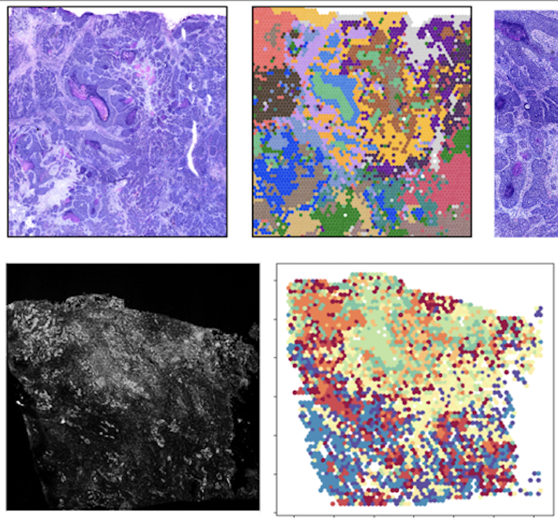 Spatial Multiomic and Multimodality Integration