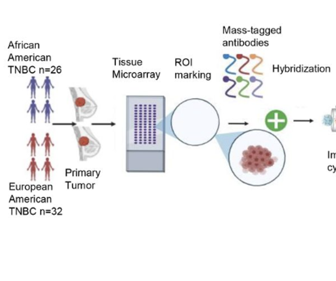 Biological Basis of Triple Negative Breast Cancer Racial Disparity