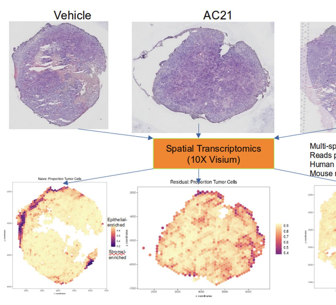 Biology of Breast Cancer Metastasis and therapeutic resistance